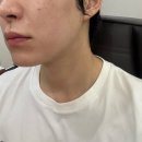 복피부과의원 | 언주역 논현동 피부과 리오셀의원 세르프 600샷 리프팅 후기