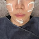 필오피스텔 | 부산 경성대 대연동 에스테틱제니룸 스킨위드바디에서 모공에 좋은 로즈필 관리 받은 후기