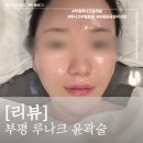 웨딩필수관리 ! 루나크 부평본점에서 3D윤곽술 받고 대만족한 솔직후기