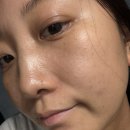 30초의 기적 | 달바 올쎄라 더블샷 2개월 후기 | 8주의 기적, 턱선이 살아나고 주름이 지워진 리얼 변화