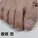 레푸스 사상점 이미지