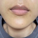 비비아나 | 꼼꼼한 손길로 자연스러운 입술 반영구 이 주일 경과 후기 광명 비비아나