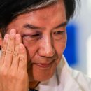 김용남, 멍든 조국에 “파란색 부러워 얼굴 시퍼렇게 만들었나” 이미지