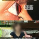 &#39;PD수첩&#39;, 라식·라섹 부작용 폭로… 안과의가 보낸 공문 &#34;충격&#34; 이미지