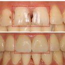 청담에이치치과의원 이미지