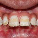 좋은치과기공소 이미지