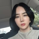V-4 | 안면거상 V템플리프트 4개월후기 (붓기,흉터)