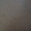 크로스메드 이미지