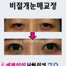 예쁜미인성형외과 이미지