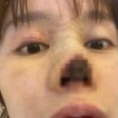 코 이미지