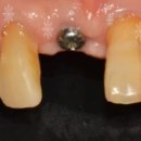 내곡웰치과의원 이미지