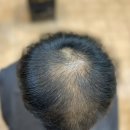 남동산업용품상가 | "아! 형이 왜 거기서 나와?" 탈모를 예술로 승화시키는 <탈모커버성형펌 덕후> 고객님의 '신세계' 리얼...