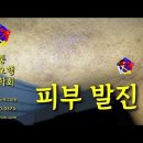 피부발진 치료 방법 및 치료 사례 - 비과학적 양의학 191 - 사암침, 사암침법, 정통사암침 이미지