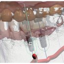연세좋은치과기공소 이미지