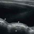 (유)한국하나로가스 이미지