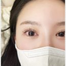 더렛빈 이미지