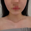 끌리메 | 대전피부관리 '끌리메 관저점' 윤곽관리 후기