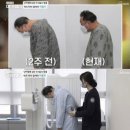 [온라인 들썩]'난치병' 이봉주, 굽은 등·지팡이 신세→수술 후 모습은 이미지