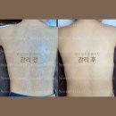 파주 운정 웨딩관리 신부케어, 본식 등드름 관리샵 후기