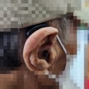 울산독일보청기 | 밀양보청기 오래간만에 방문하신 고객님, 보청기 재구매후기입니다.