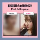 탑클래스성형외과의원 이미지