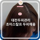 초이네 | 초이스칼프 정수리 대전두피관리 후기