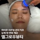 창원 신월동 피부관리 엘그로우뷰티, LDM물방울 하이푸 리프팅 즉각 변화 후기