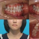 정DENTAL 이미지