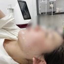 투턱 이미지
