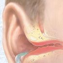 포낙보청기수원센터 이미지