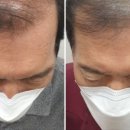고은하늘성형외과 네이버블로그