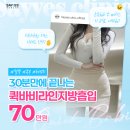 예슬림의원 | 강남 지방흡입수술 잘하는곳 3개월차 후기 사진, 비용과 유지기간에 대하여