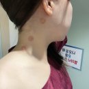 화타한의원 | 목 뒤 뼈 통증 청담역한의원 추나요법 가격 도침치료 명의
