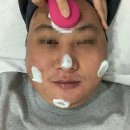 정원장의 모공세척테라피 이미지