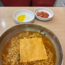 신안과의원 | 신논현역 ㅅㅇㅅ안과 라섹, 강막강화술 내돈내산 수술당일~5일 후기