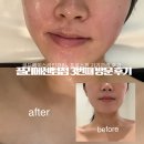 끌리메 | 3번째 방문 해운대 에스테틱 골드 페이스라인 끌리메 센텀점 후기