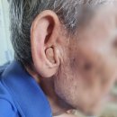 두드림 보청기 이미지