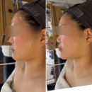 움트다 에스테틱 | 마곡 윤곽관리 움트다에스테틱 호텔스파 안부러운 맞춤조각 리프팅