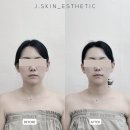 더제이메디칼 | 대구 동성로 윤곽 관리ㅣ대구 신부관리 제이스킨 후기