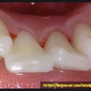 서울프리벤치과의원 이미지