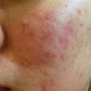 피브엔의원 이미지