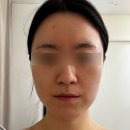 야리3길 | 양산 온스에스테틱 프리미엄뱀부 윤곽관리 후기