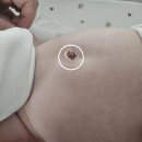 담소유병원 | 담소유병원 소아 탈장 수술 후기｜당일 진료· 당일수술· 당일퇴원의 압도적장점