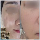 펜타힐즈3로 L | 경산피부관리 잘하는곳,피부열감l붉은기 잡는 &#39;물오른피부&#39; 경산점 후기!