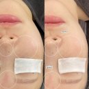 수유역피부관리 요이에스테틱 셀룰러케어 후기