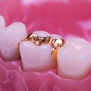 퍼즐치과기공소 이미지