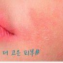 더고은피부관리실 이미지