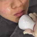 아더뷰티크스킨왁싱 | 피지 고민 끝! 선릉 피부관리는 역시 뷰티크나인 스킨앤왁싱! 블랙헤드 집중 관리 후기!