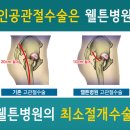 [고관절인공관절] 노인 고관절 골절, 합병증으로 위험가능성 높아 빨리 수술해야 이미지