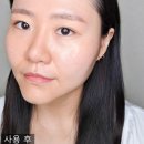 (주)에디뷰티코리아 | 뷰티디바이스 종류 슈링크홈 리프투글로우 SNL코리아 볼륨광앰플 조합